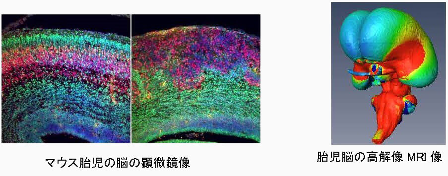 マウス胎児の脳の顕微鏡像 胎児脳の高解像MRI像