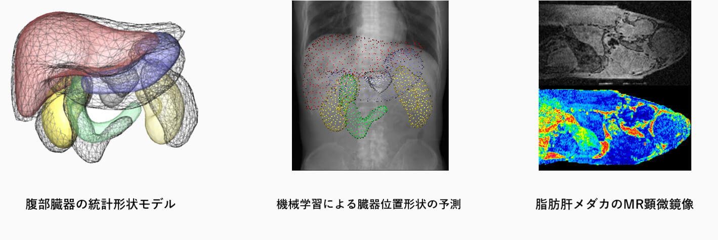 腹部臓器の統計形状モデル 機械学習による臓器位置形状の予測　脂肪肝メダカのMRI顕微鏡像