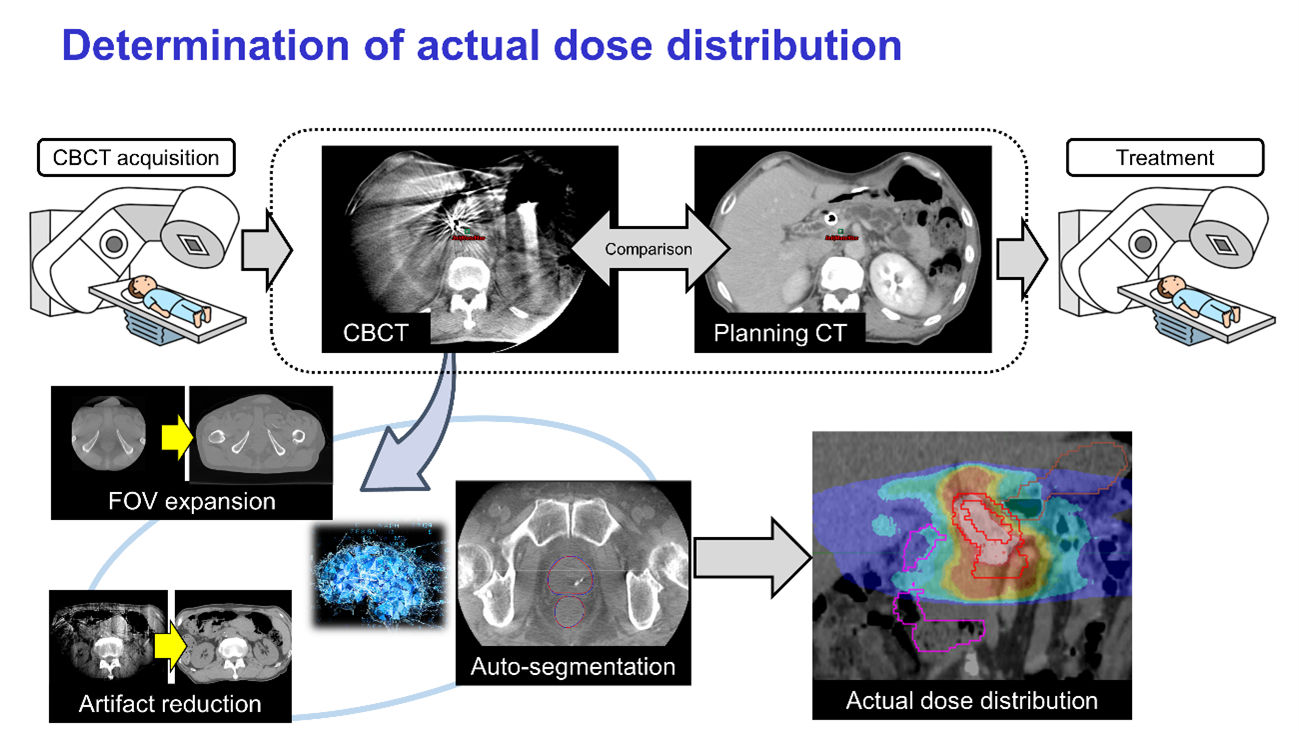 Determination of actual dose distribution