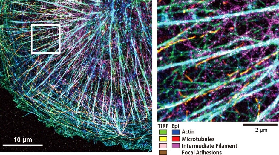 神経細胞図２